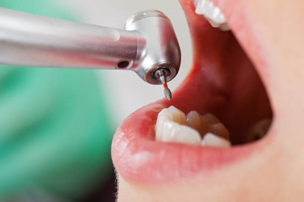 Best Emergency Treatment for Oral Infections in Riverton, IL
